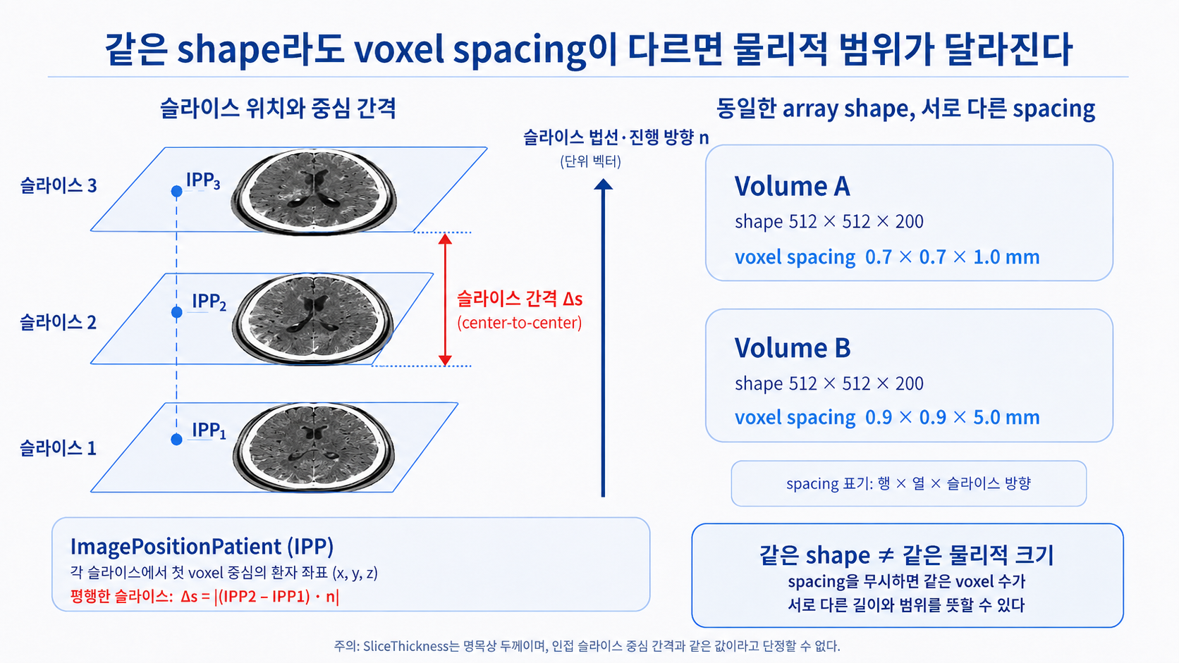 세 개의 평행한 합성 뇌 단면에 IPP1, IPP2, IPP3 기준점과 슬라이스 법선 n, 인접 슬라이스 중심 간격 Δs를 표시하고, 동일한 512×512×200 shape에서 서로 다른 voxel spacing을 가진 Volume A와 Volume B를 비교한 도식.