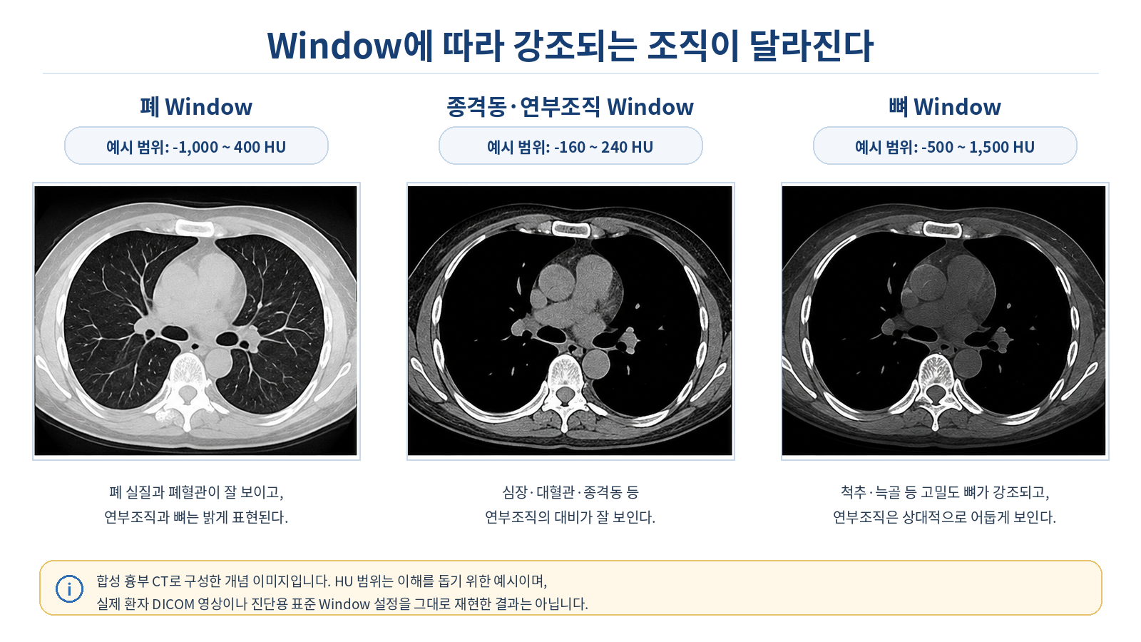 합성 흉부 CT를 폐, 종격동·연부조직, 뼈 Window로 비교한 3패널 이미지. 예시 HU 범위는 각각 -1000~400, -160~240, -500~1500이다.