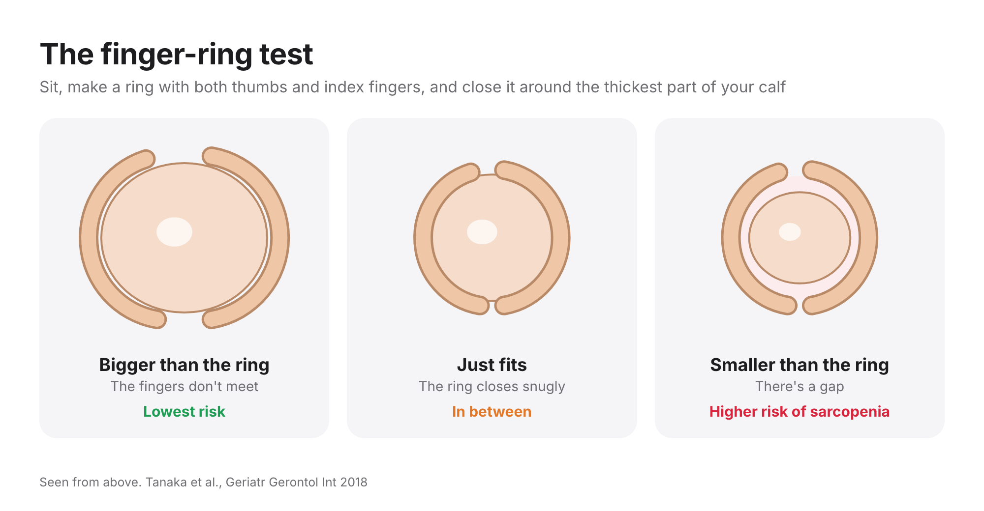 The finger-ring test seen from above: calf bigger than the ring (lowest risk), just fits (in between), smaller with a gap (higher risk)