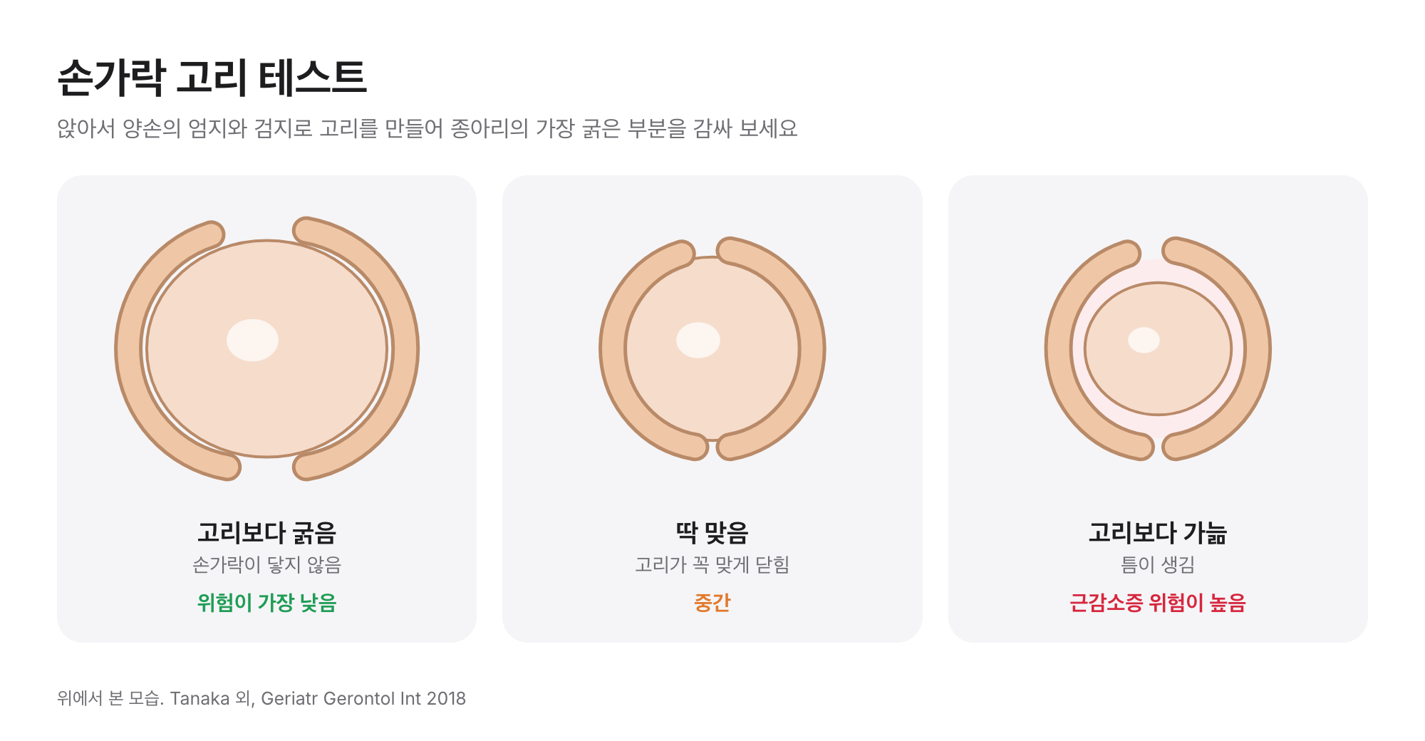 위에서 본 손가락 고리 테스트: 종아리가 고리보다 굵음(위험 낮음), 딱 맞음(중간), 가늘어 틈이 생김(위험 높음)