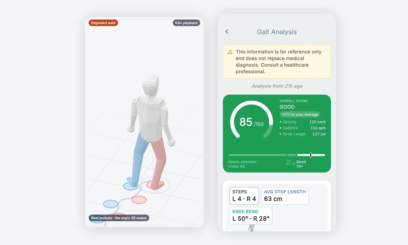 Step Doctor gait result: the 3D avatar replay next to the result screen with a gait score of 85