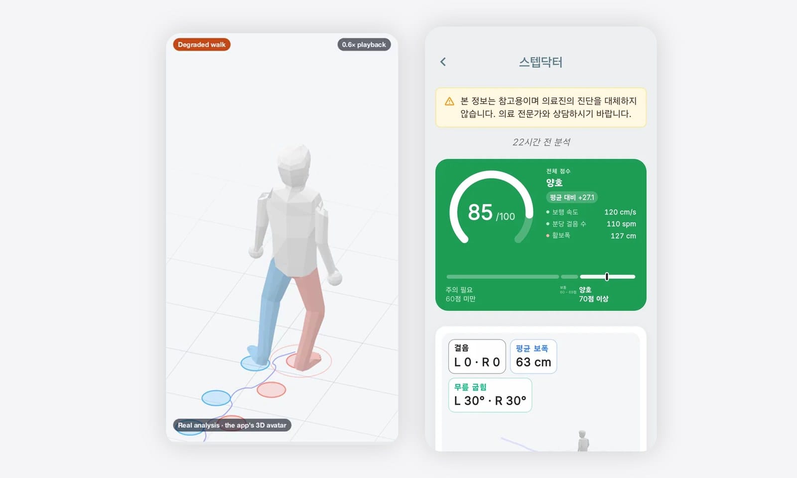 스텝닥터 보행 결과: 3D 아바타 다시 보기와 보행 점수 85점 결과 화면