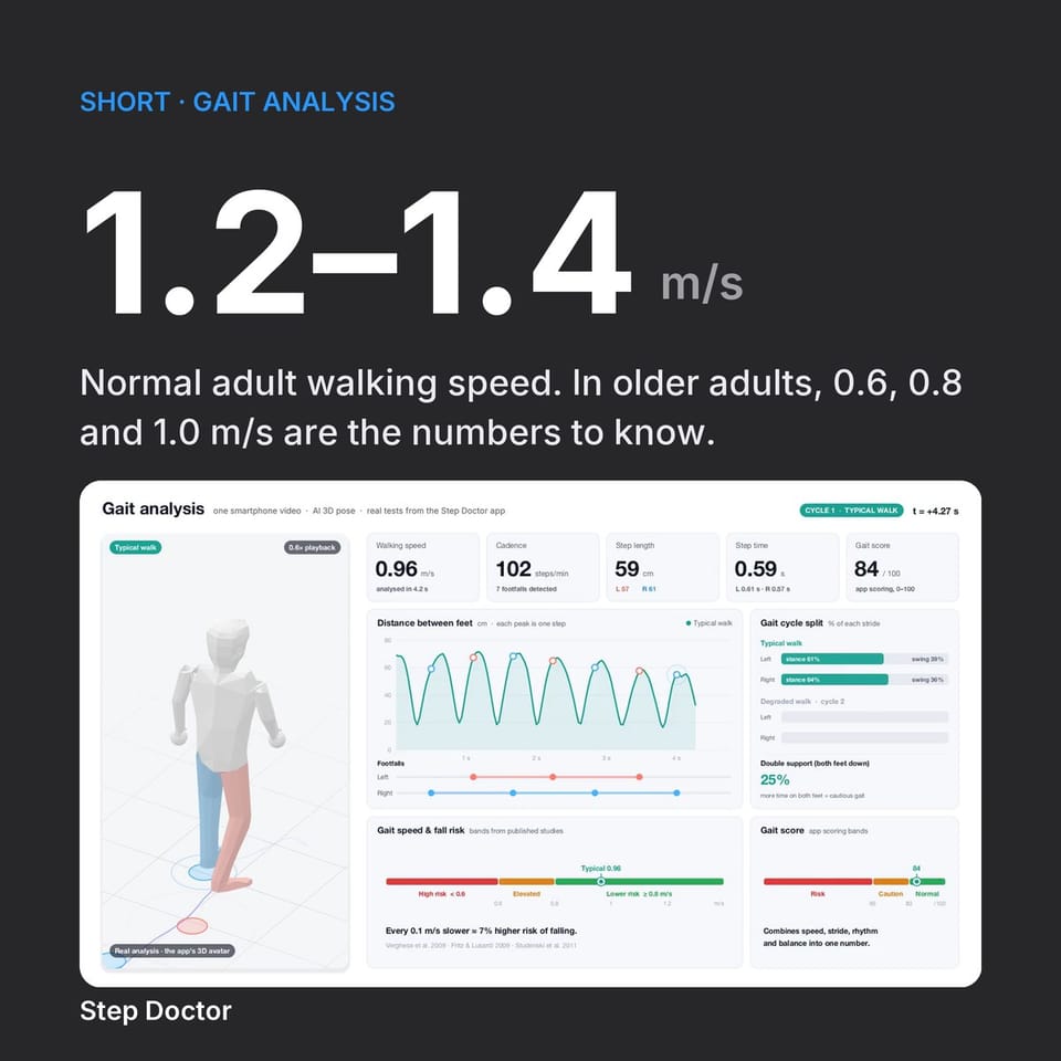 Normal Walking Speed: The Numbers Worth Knowing